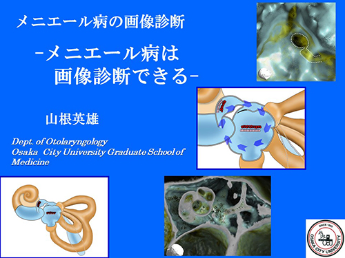 ��܂ˎ��@��A�� �R���p�Y